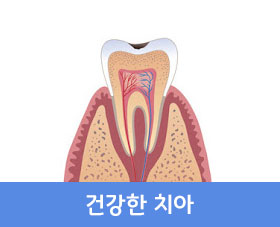 건강한 치아
